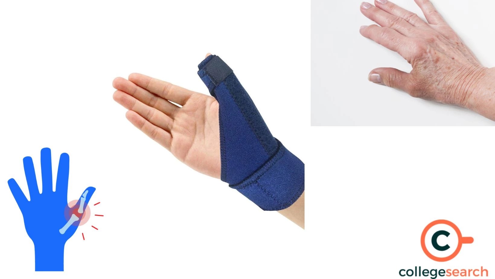 Saddle Joint Definitions, Examples, Origin, Features, Movement, Functions, Structure, and